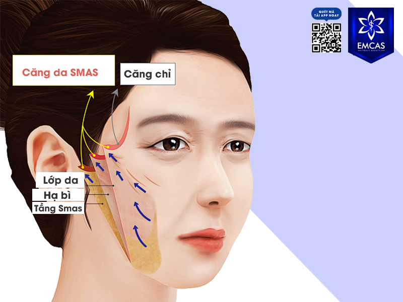 Căng Da Mặt ADM