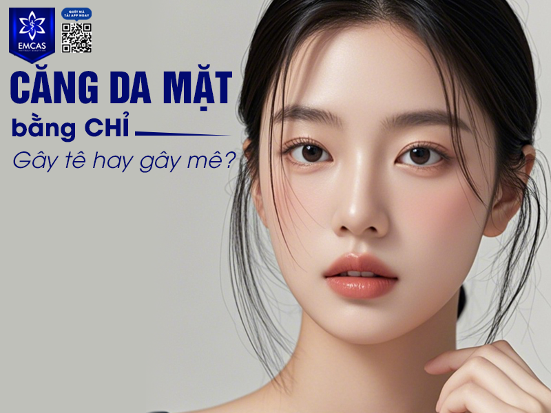 Cấy Chỉ Nâng Cơ, Căng Da Không Phẫu Thuật