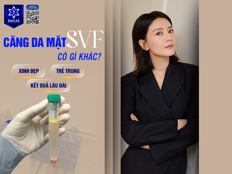 Căng Da Mặt SVF Có Gì Khác?