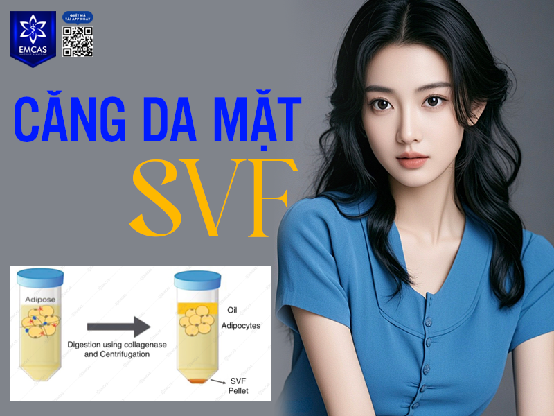 Căng Da Mặt SVF Có Gì Khác?