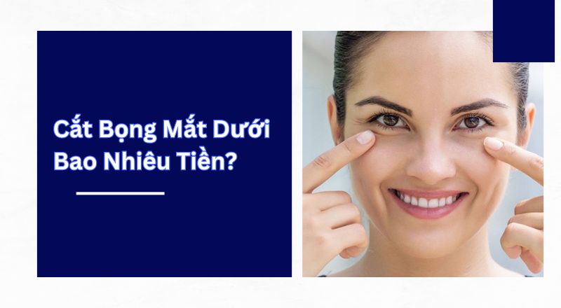 Cắt Bọng Mắt Dưới Bao Nhiêu Tiền?