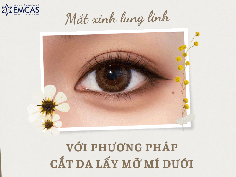 CẮT DA VÀ LẤY MỠ MÍ DƯỚI