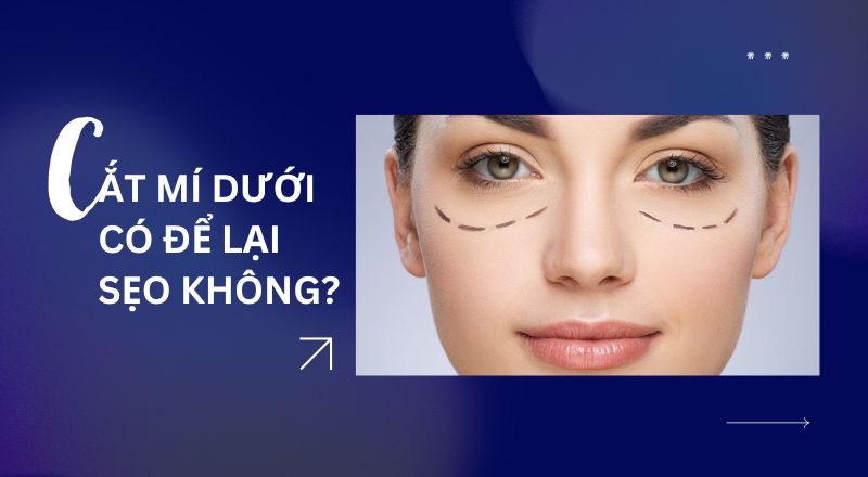 Cắt Mí Dưới Có Để Lại Sẹo Không?