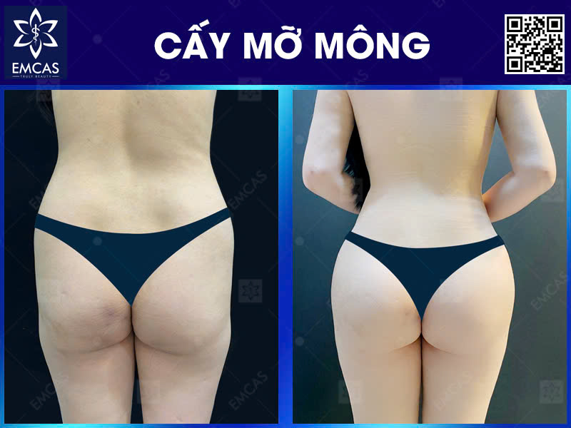 Thế Nào Là Vòng 3 Đẹp?