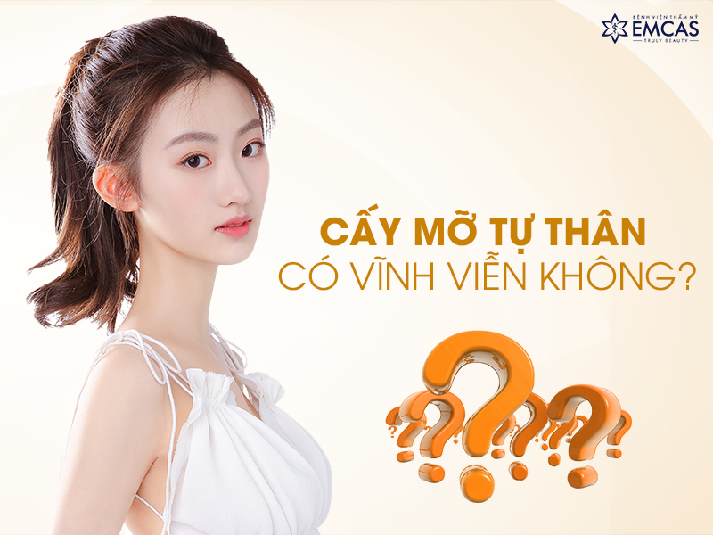 Cấy Mỡ Tự Thân Có Được Vĩnh Viễn Hay Không