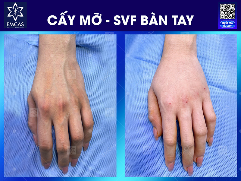 4 Sản Phẩm Làm Đẹp Từ Mỡ