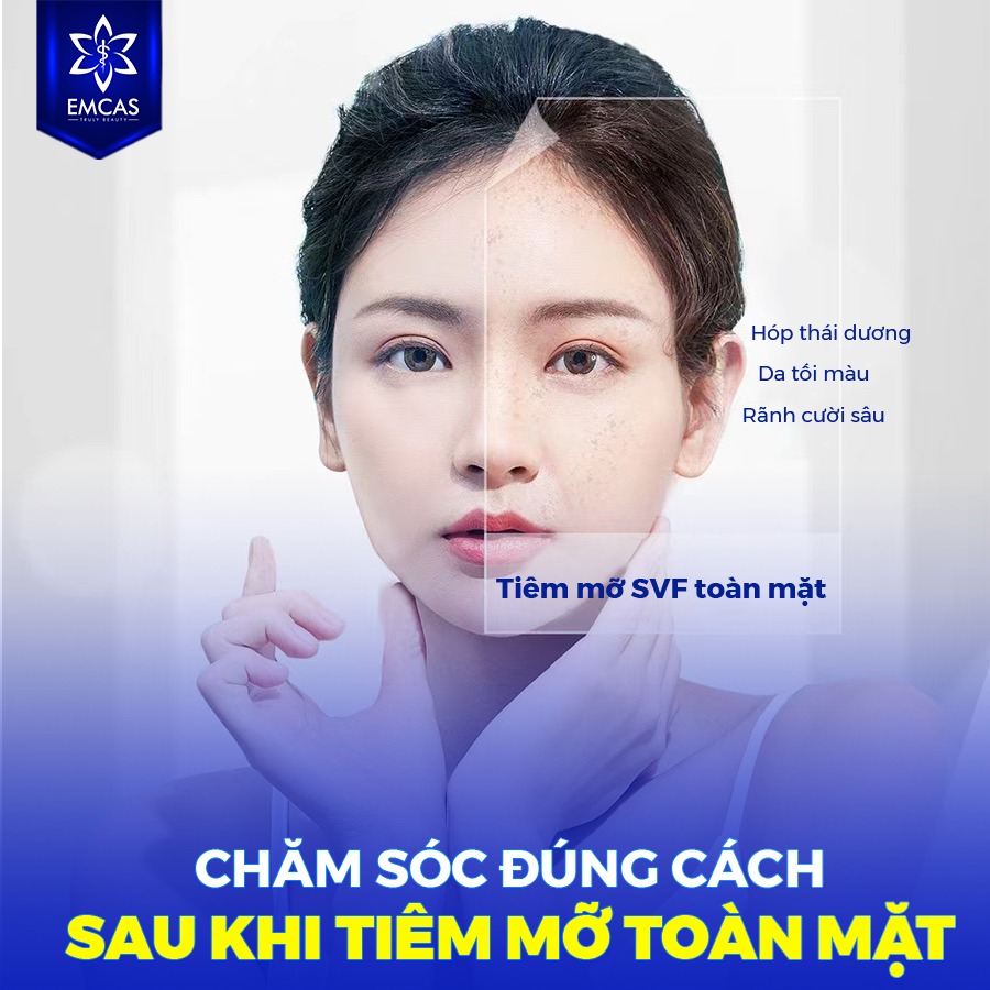 Lợi Ích Của Phương Pháp Tiêm Mỡ Toàn Mặt Là Gì?