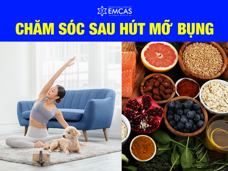 Hút Mỡ Bụng Là Gì?