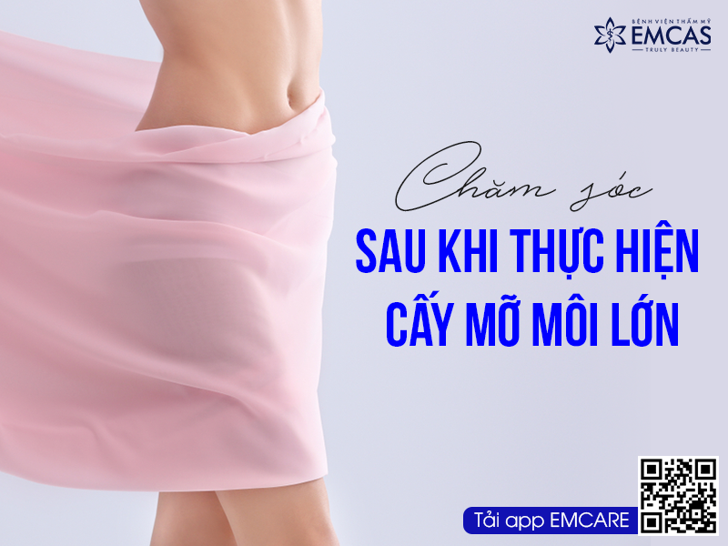 CẤY MỠ MÔI LỚN