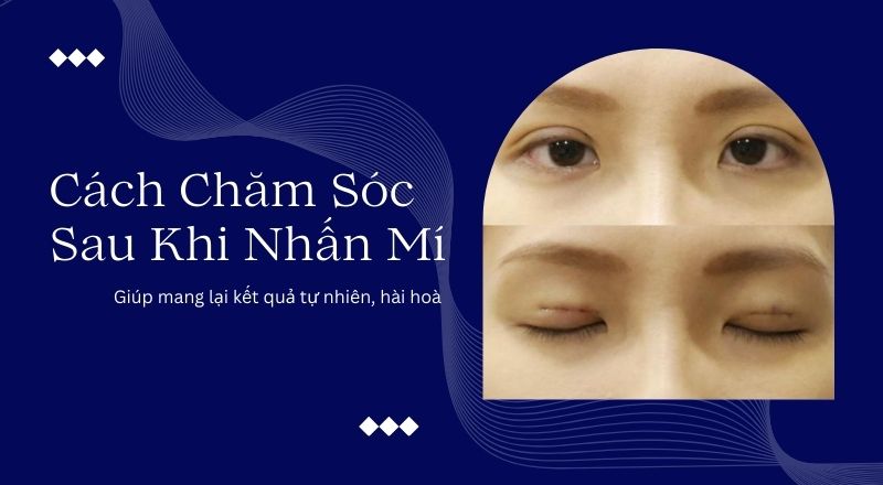 Hướng Dẫn Chăm Sóc Sau Khi Nhấn Mí Giúp Mang Lại Kết Quả Tự Nhiên