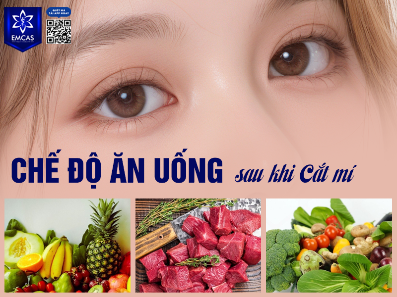 Cắt Mí Có Để Lại Sẹo Không? Cách Chăm Sóc Để Mí Đẹp Tự Nhiên