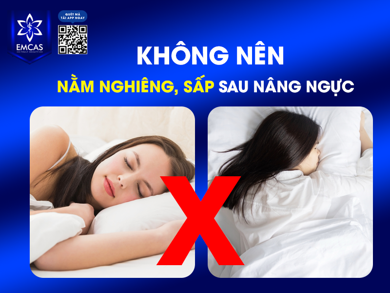 7 Lưu Ý Sau Khi Nâng Ngực