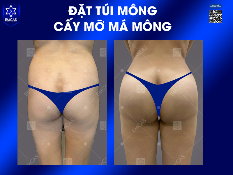 Thế Nào Là Vòng 3 Đẹp?