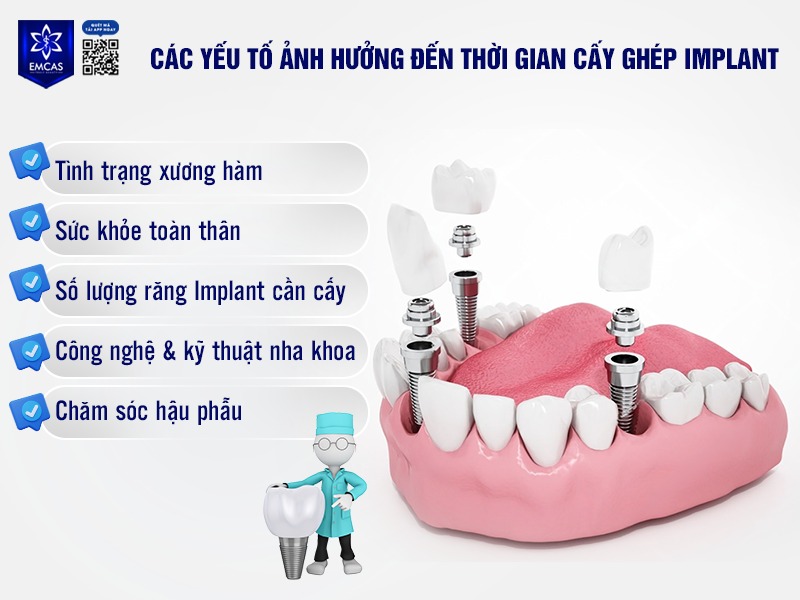 Thời gian cấy ghép răng Implant không hoàn toàn giống nhau ở mỗi người, phụ thuộc vào 5 yếu tố