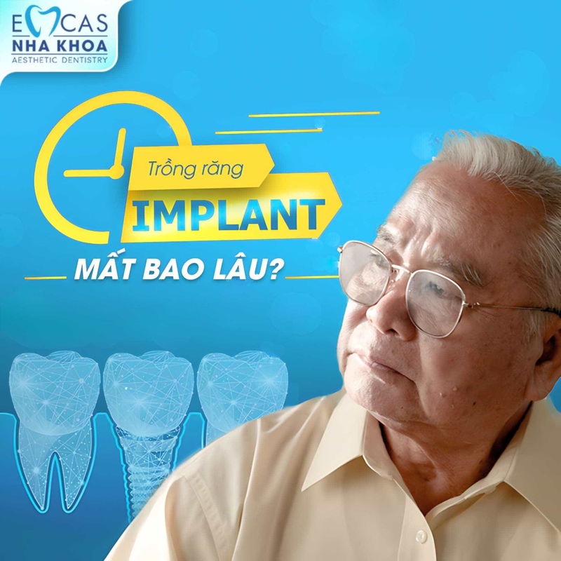 Trong điều kiện lý tưởng thời gian hoàn thiện 1 ca cấy ghép Implant có thể chỉ từ 1 – 2 tháng