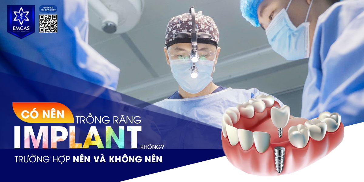 CÓ NÊN TRỒNG RĂNG IMPLANT KHÔNG? TRƯỜNG HỢP NÊN VÀ KHÔNG NÊN