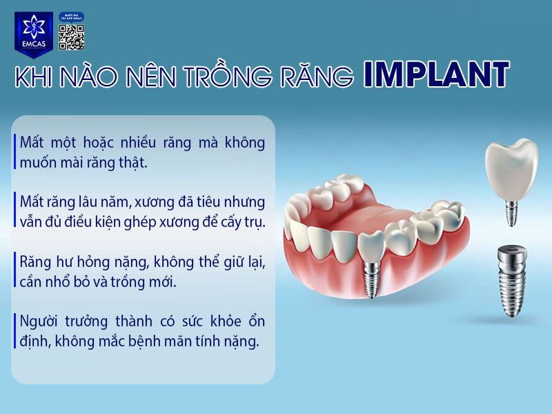 Bạn nên cấy Implant càng sớm càng tốt sau khi mất răng, vì nếu để lâu, xương sẽ tiêu dần và việc phục hình sẽ khó khăn, tốn kém hơn