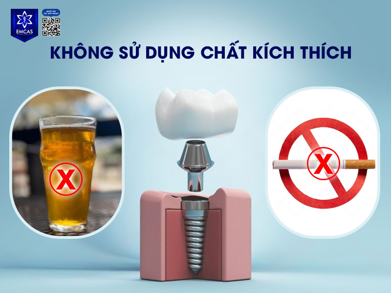 Rượu, bia, thuốc lá,... có thể làm giảm lưu lượng máu đến nướu, cản trở quá trình lành thương và tăng nguy cơ nhiễm trùng hoặc đào thải trụ Implant