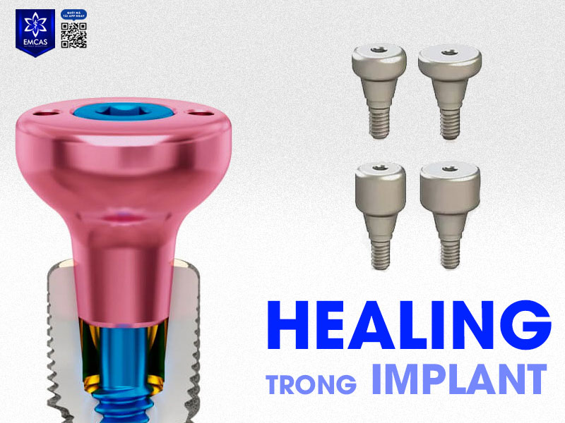 Healing là một trụ lành thương, được vặn vào trụ Implant sau khi đã tích hợp với xương hàm