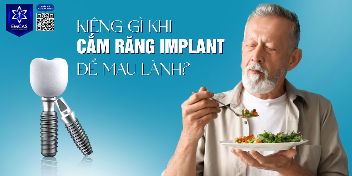 KIÊNG GÌ KHI CẮM RĂNG IMPLANT ĐỂ MAU LÀNH?