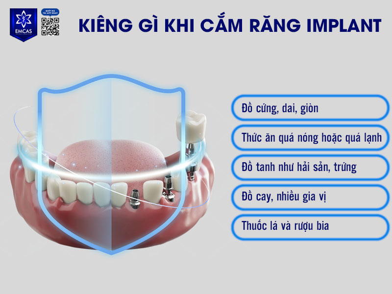 Cần kiêng một số loại thực phẩm và thói quen có thể gây viêm nhiễm, ảnh hưởng đến khả năng tích hợp của trụ Implant