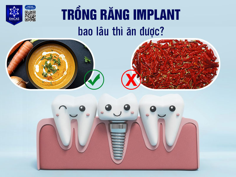 Từ tuần thứ 2 trở đi, tùy cơ địa và tốc độ lành thương, bạn có thể bắt đầu ăn uống gần như bình thường
