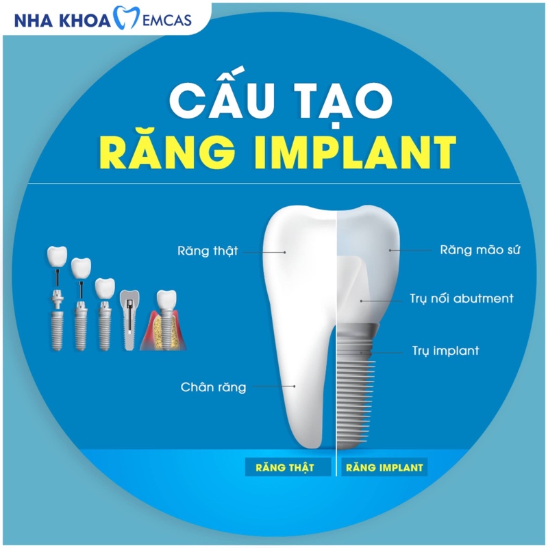 Trụ là phần thay thế chân răng, nằm trong xương hàm suốt đời do đó nên lựa chọn loại trụ chất lượng tốt để đảm bảo an toàn