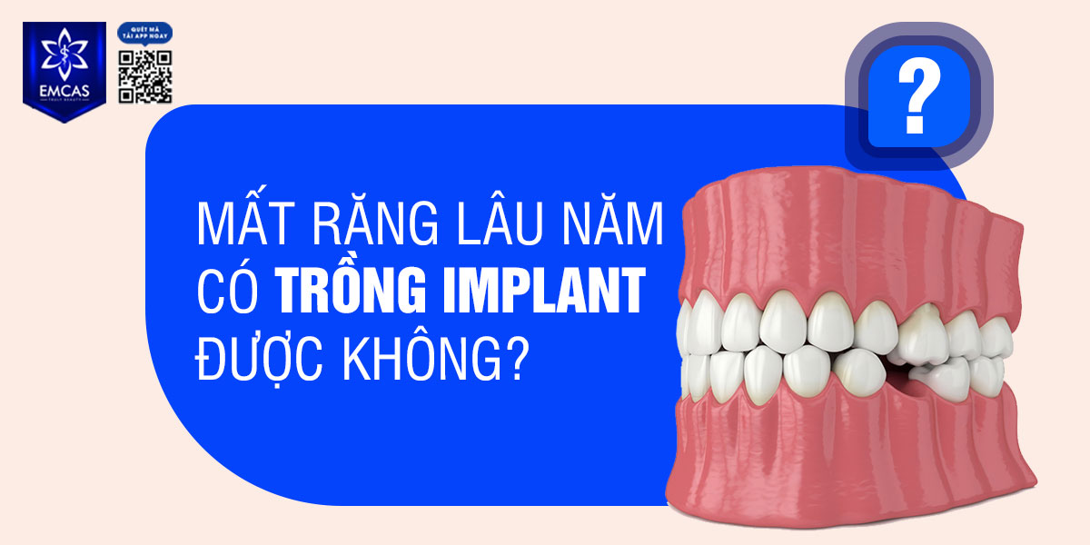 MẤT RĂNG LÂU NĂM CÓ TRỒNG IMPLANT ĐƯỢC KHÔNG?