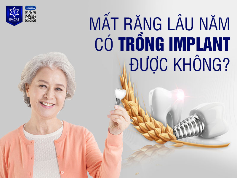 Mất răng lâu năm hoàn toàn có thể trồng Implant được tuy nhiên sẽ phụ thuộc vào tình trạng tiêu xương và sức khỏe tổng quát của bệnh nhân