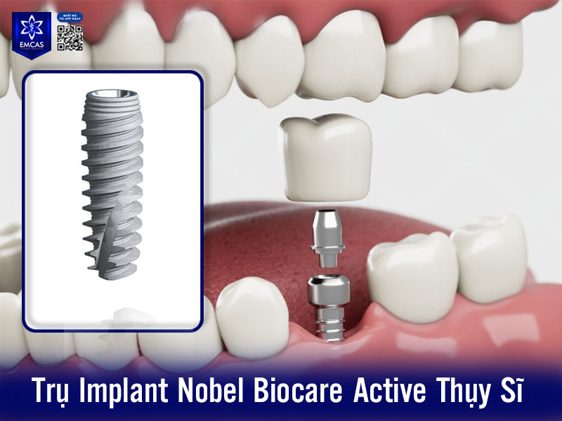 Trụ Implant Nobel Biocare Active là dòng Implant cao cấp của công ty Nobel Biocare –Thụy Sĩ