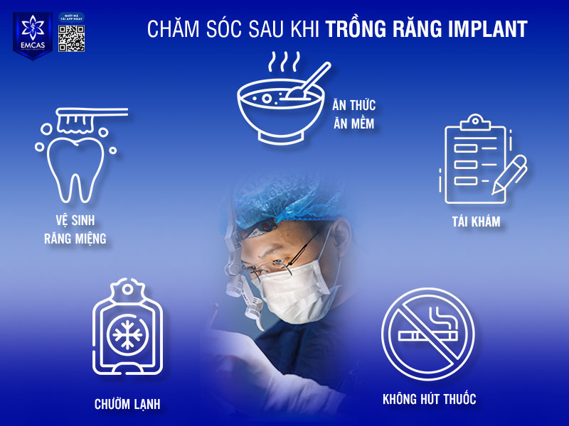 chăm sóc sau khi trồng Implant đóng vai trò cực kỳ quan trọng trong việc đảm bảo trụ Implant tích hợp tốt với xương hàm và hạn chế biến chứng