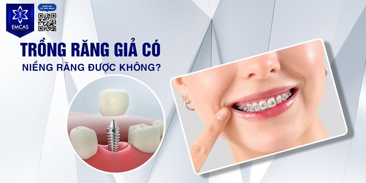 TRỒNG RĂNG GIẢ CÓ NIỀNG RĂNG ĐƯỢC KHÔNG?