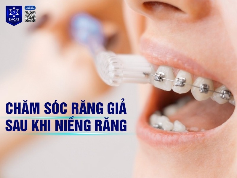 Để kết quả niềng răng được như mong muốn cũng như duy trì kết quả lâu dài thì việc chăm sóc đúng cách là một trong những điều kiện tiên quyết