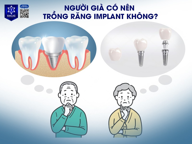 Người già nên trồng răng Implant nhưng cần đánh giá kỹ tình trạng sức khỏe toàn thân, mật độ xương hàm và một số yếu tố y khoa khác