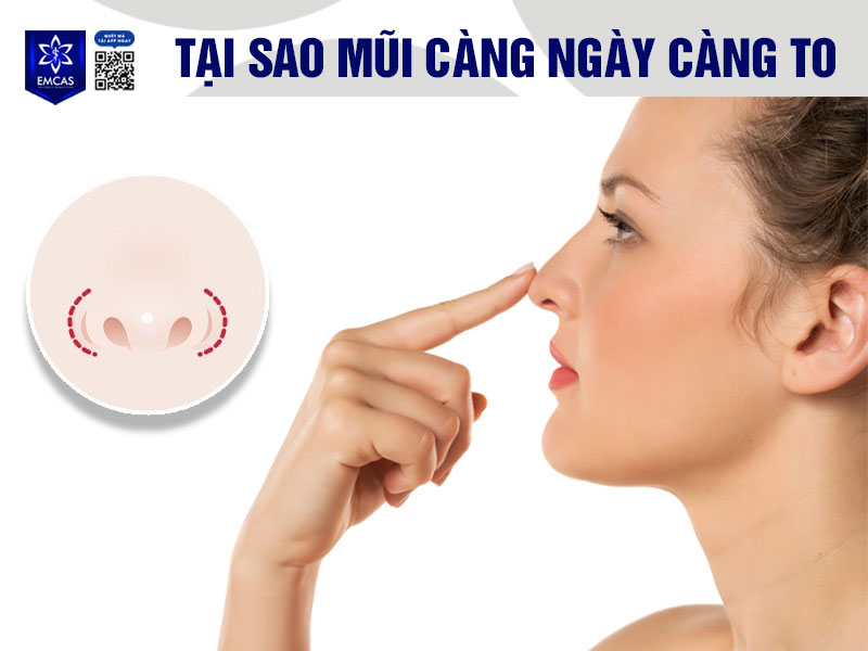 Một trong những nguyên nhân dẫn đến tình trạng mũi to là do tuổi tác tác tăng dần, collagen và elastin trong da bắt đầu suy giảm
