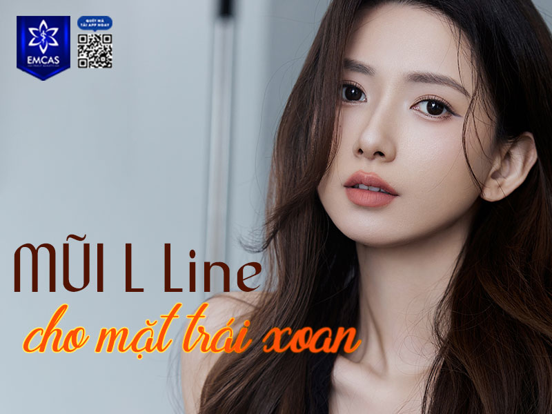 Các dáng mũi đẹp phù hợp với mặt trái xoan như mũi S-line để giữ nét tự nhiên hoặc mũi L-line nếu muốn khuôn mặt trông thời thượng, hiện đại hơn.