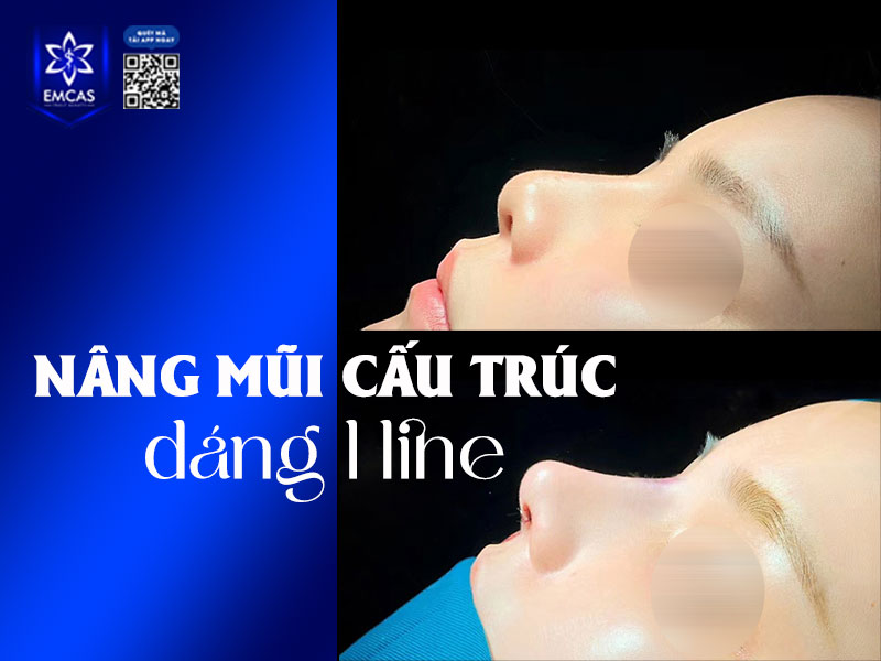 Mũi L-line có đường sống cao và phần đầu mũi vươn nhẹ ra phía trước, tạo dáng chữ L thanh mảnh.