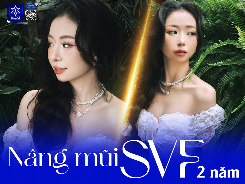 Tùy vào nhu cầu và điều kiện cá nhân, bạn có thể lựa chọn những cách tự nhiên hoặc các kỹ thuật thẩm mỹ tiên tiến để sở hữu dáng mũi cao chuẩn đẹp, hài hòa và an toàn.