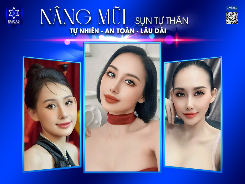 Không chỉ mang yếu tố thẩm mỹ, nâng mũi còn giúp chỉnh sửa những khuyết điểm về cấu trúc như lệch vách ngăn, đầu mũi thấp, hay cánh mũi to.