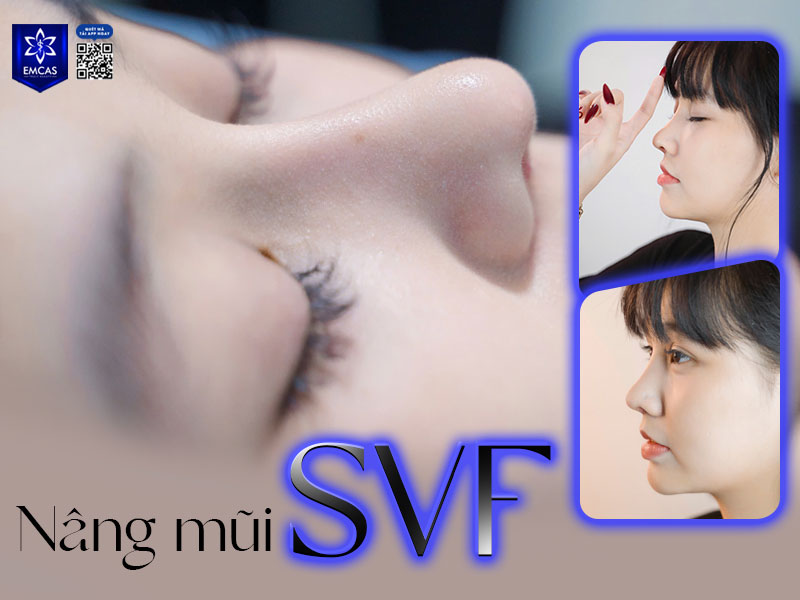 Chi phí dịch vụ này tại EMCAS khoảng từ 23 triệu đồng trở lên, còn tùy thuộc vào loại sụn mà bạn sử dụng cũng như các công nghệ đi kèm