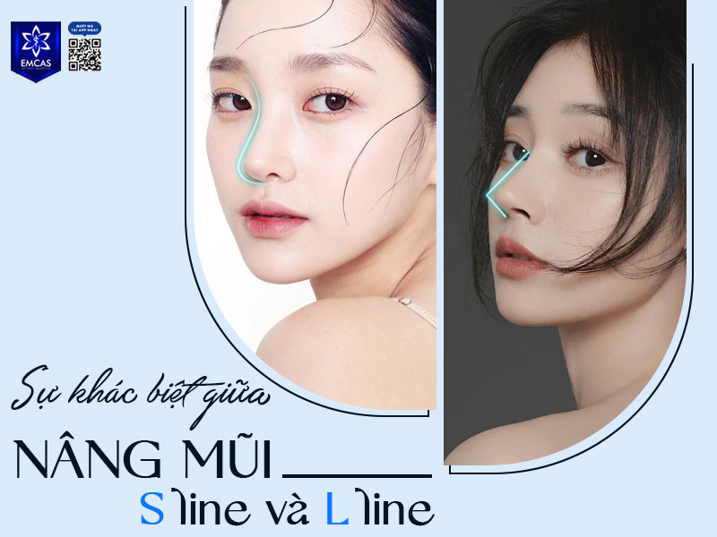 dáng mũi S Line hay L Line còn phụ thuộc vào cấu trúc mũi, đường nét khuôn mặt và nhu cầu thẩm mỹ của mỗi người