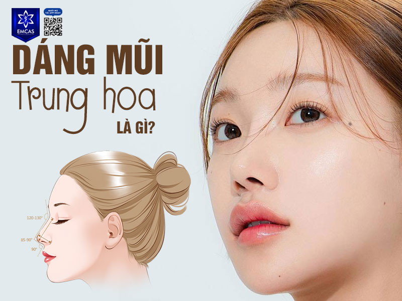 Dáng mũi Trung Hoa là kiểu mũi được định hình bởi sống mũi thanh thoát, có độ cao vừa phải, nhẹ nhàng cong bay như dáng S line.