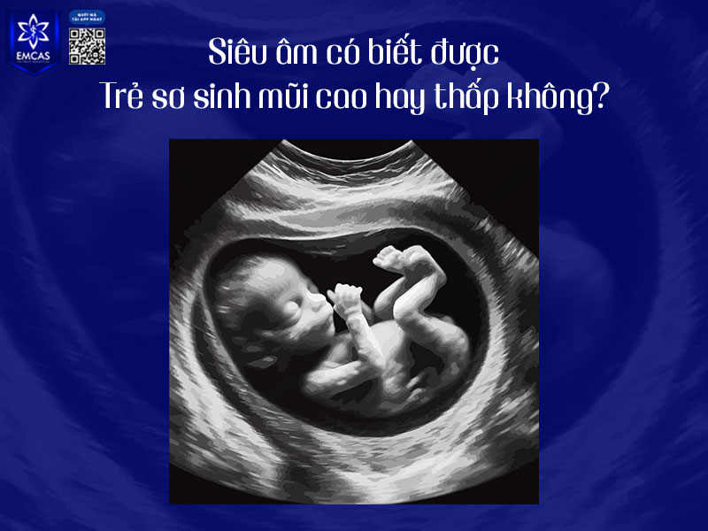 Siêu âm thai không thể xác định chính xác mũi cao hay thấp của thai nhi