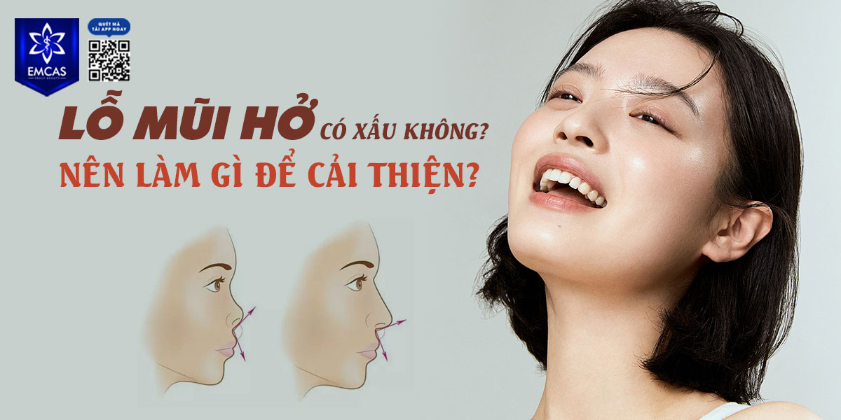 LỖ MŨI HỞ CÓ XẤU KHÔNG?