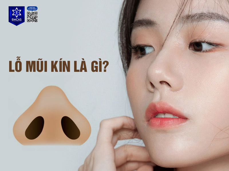Lỗ mũi kín là một kiểu hình dáng mũi đặc trưng với phần lỗ mũi nhỏ, hẹp và có xu hướng ẩn sâu vào trong