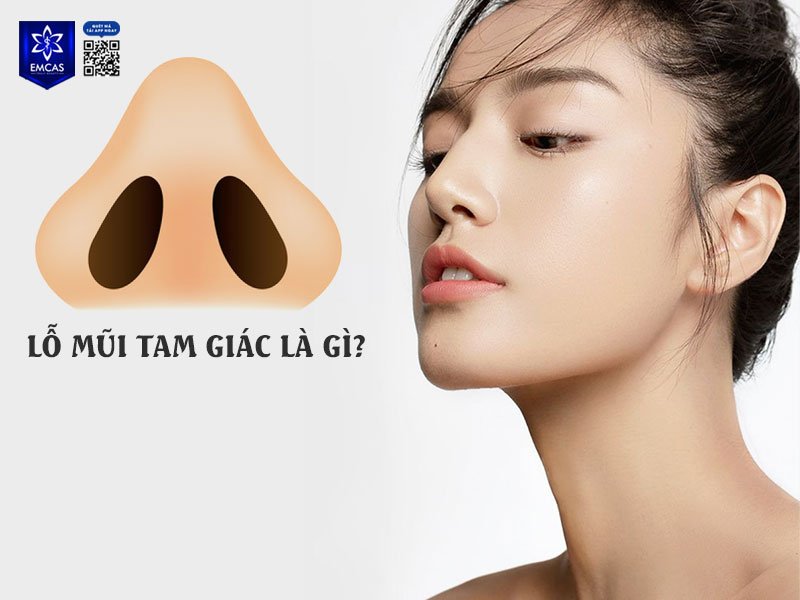 Lỗ mũi tam giác là một hình dáng lỗ mũi có cấu trúc tương đối đặc biệt, khi nhìn từ dưới lên sẽ thấy phần lỗ mũi tạo thành hình tam giác rõ rệt.