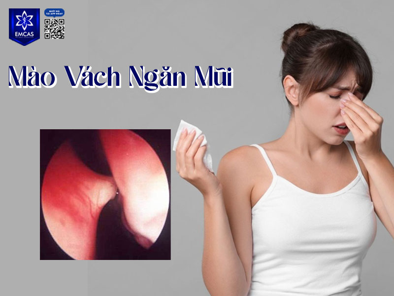 Mào vách ngăn mũi là phần xương hoặc sụn nhô lên bất thường tại chân vách ngăn, được xem là một biến dạng thuộc nhóm lệch vách ngăn.