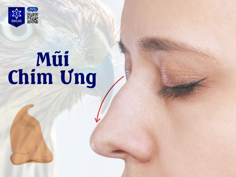 Mũi chim ưng dễ nhận diện với phần sống mũi cao, đầu mũi nhọn và khoằm xuống giống như mỏ chim ưng