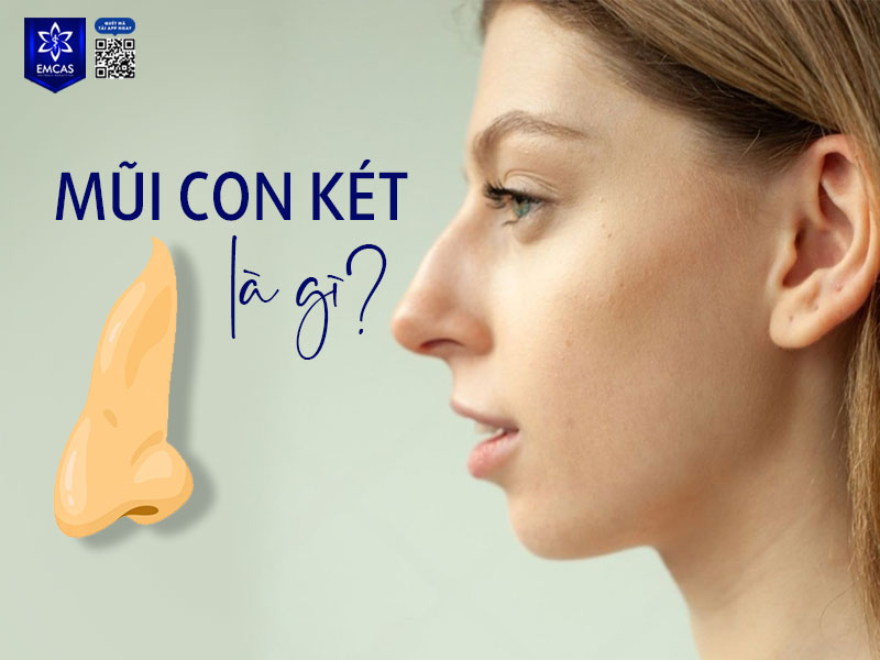Mũi con két là cách gọi dân gian dùng để chỉ một kiểu dáng mũi có phần sống cong xuống và đầu mũi nhọn, quặp nhẹ giống như mỏ của loài chim két