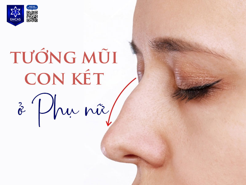 Với nữ giới, mũi dáng con két thường mang lại vẻ ngoài sắc sảo, có phần “đanh thép”